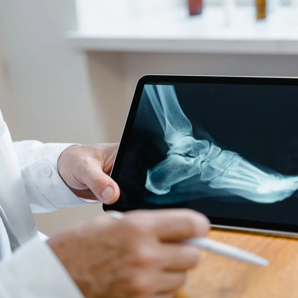 Doctor reviewing a foot X-ray on a tablet